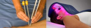 Light THerapy & Acutonic Therapy